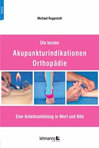 Die besten Akupunkturindikationen Orthopadie: Eine Arbeitsanleitung in Wort und Bild