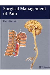 Surgical Management of Pain