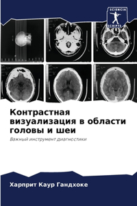 Контрастная визуализация в области голов