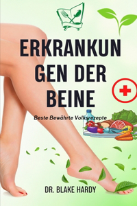 Erkrankungen Der Beine