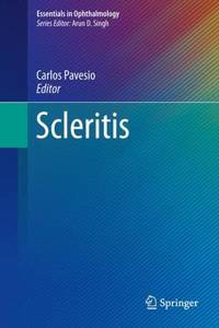 Scleritis