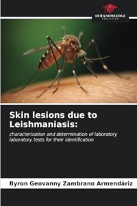 Skin lesions due to Leishmaniasis