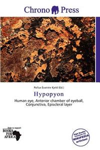 Hypopyon