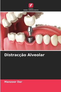 Distracção Alveolar