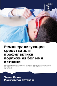 Реминерализующие средства для профилак