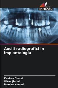 Ausili radiografici in implantologia