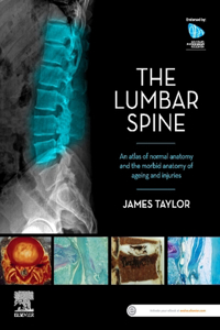 Lumbar Spine