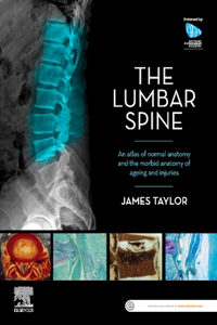 Lumbar Spine