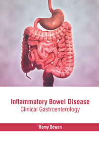 Inflammatory Bowel Disease: Clinical Gastroenterology