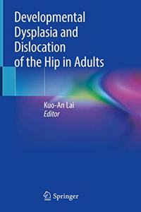 Developmental Dysplasia and Dislocation of the Hip in Adults