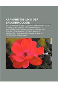 Krankheitsbild in Der Endokrinologie: Hypothyreose, Hyperthyreose, Diabetes Mellitus, Klinefelter-Syndrom, Hypogonadismus