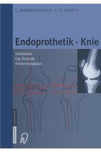 Endoprothetik Knie