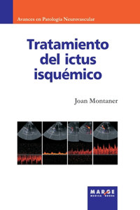 Tratamiento del ictus isquémico