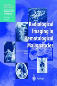 Radiological Imaging in Hematological Malignancies