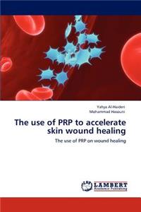 use of PRP to accelerate skin wound healing