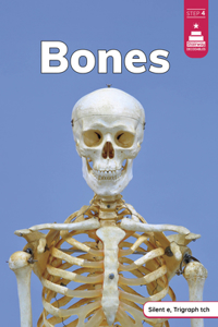 Bones