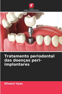 Tratamento periodontal das doenças peri-implantares