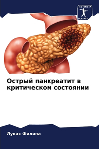 Острый панкреатит в критическом состояни