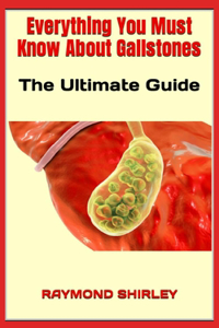 Everything You Must Know About Gallstones