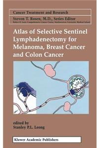 Atlas of Selective Sentinel Lymphadenectomy for Melanoma, Breast Cancer and Colon Cancer