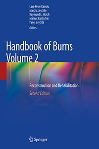 Handbook of Burns Volume 2