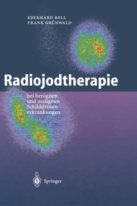 Radiojodtherapie