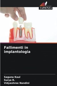 Fallimenti in implantologia