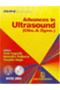 Advances in Ultrasound