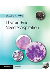 Thyroid Fine Needle Aspiration with CD Extra