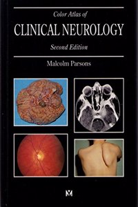 Color Atlas of Clinical Neurology