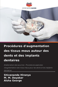 Procédures d'augmentation des tissus mous autour des dents et des implants dentaires