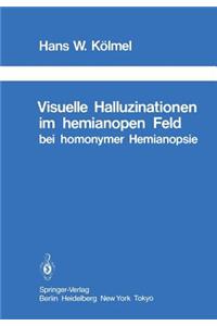 Visuelle Halluzinationen Im Hemianopen Feld Bei Homonymer Hemianopsie