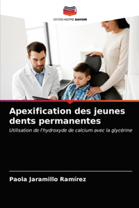 Apexification des jeunes dents permanentes