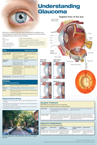 Understanding Glaucoma