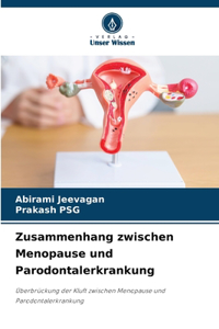 Zusammenhang zwischen Menopause und Parodontalerkrankung