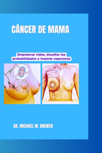 Cáncer de Mama