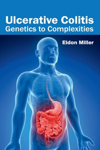Ulcerative Colitis: Genetics to Complexities