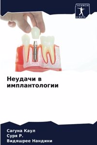 Неудачи в имплантологии