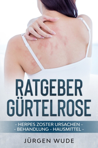 Ratgeber Gürtelrose