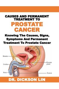Causes and Permanent Treatment to Prostate Cancer
