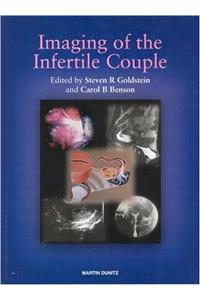 Imaging of the Infertile Couple