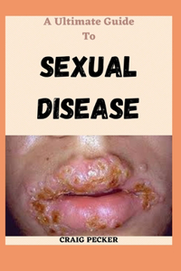 A Ultimate Guide To Sexual Disease