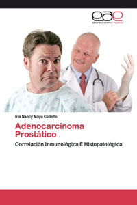 Adenocarcinoma Prostático
