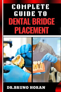 Complete Guide to Dental Bridge Placement