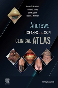 Andrews' Diseases of the Skin Clinical Atlas, E-Book