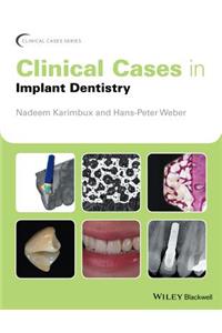 Clinical Cases in Implant Dentistry