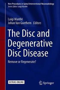 Disc and Degenerative Disc Disease