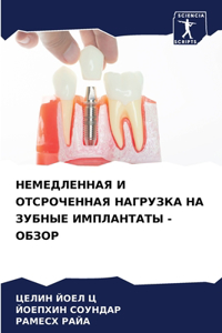 НЕМЕДЛЕННАЯ И ОТСРОЧЕННАЯ НАГРУЗКА НА ЗУБ