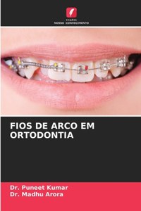 Fios de Arco Em Ortodontia