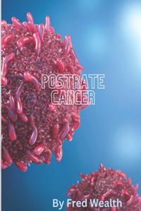 Postrate Cancer